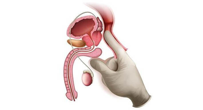 前立腺の説明図